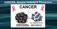 Do's and Don'ts for the Natural Healing & Prevention of Cancer
